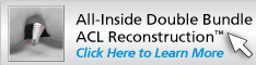 All-Inside Double<br>
						Bundle ACL Reconstruction™