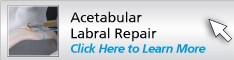 Acetabular Labral Repair